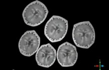 112 — MRI of different Fruit